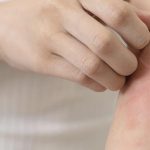 از خستگی شدید تا التهاب ریه؛ علائم بیماری تازه‌کشف‌شده VEXAS
