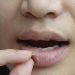 چرا مرطوب کردن لب‌ها با زبان در زمستان وضعیت آن‌ها را بدتر می‌کند؟