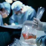 سقاب و تبدیل غم بزرگ به کار بزرگ | ایران مقام اول اهدای عضو در آسیا را دارد