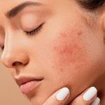 شیرینی پرطرفداری که پوست را تیره و پیر می‌کند